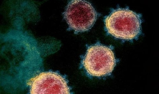 电脑查出新冠病毒，冠形病毒