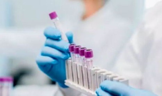 密接人员核酸检测几次，次密切接触者隔几天做一次核酸检测