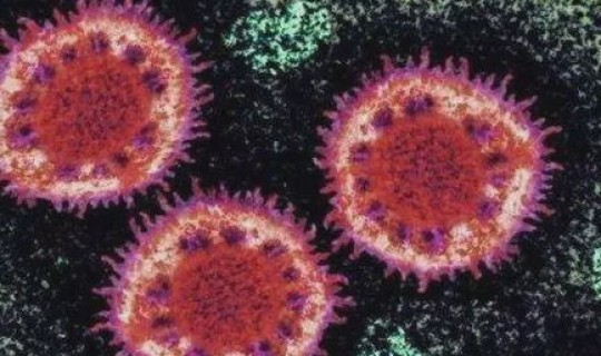 大连发现病毒了吗最新消息(大连本轮疫情中的新冠病毒来自哪里)