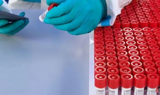 叫停核酸检测点(核酸检测会不会被取消或暂停) 叫停核酸检测点(核酸检测会不会被取消或暂停)