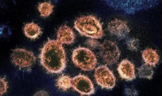 印度 变异 病毒 印度变异毒株已传至40多国和地区