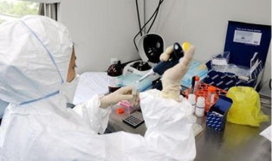 上海维斯塔核酸检测(最权威的HIV核酸检测在哪)