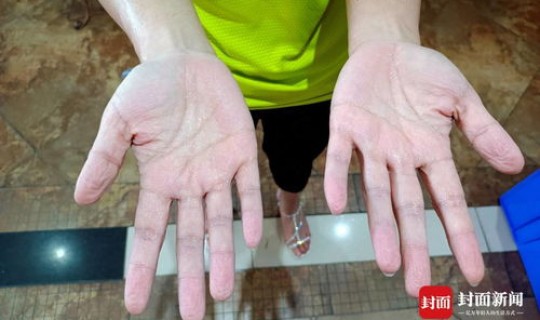 成都无新增病例多少天(无新增病例多少天可以解封)