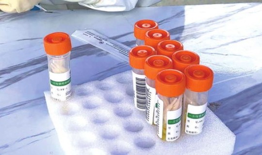 单管混检 混管检测是什么意思