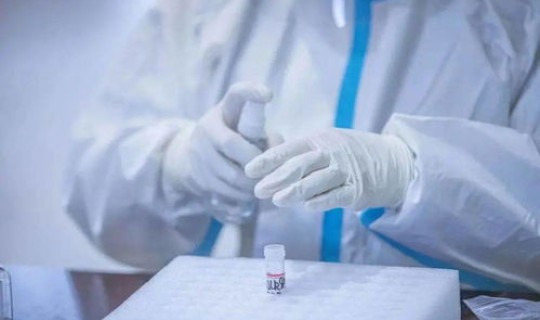 不需要核酸检测吗，不需要做核酸检测