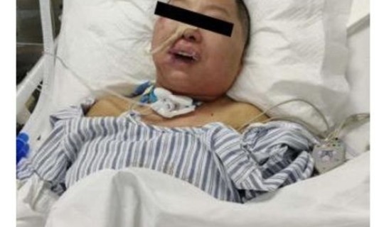 新冠肺炎感染者的感受？得了新冠肺炎有哪些感受啊